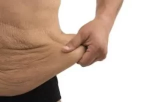 En hand håller i lös hud efter viktnedgång